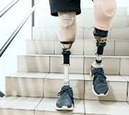 Amputation Surgery Cost in Mogappair
